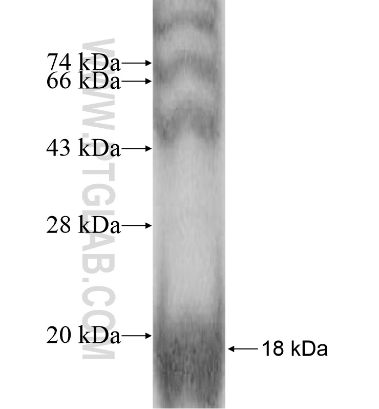 SPANXB1 fusion protein Ag10636 SDS-PAGE SPANXB1 fusion protein Ag10636 SDS-PAGE