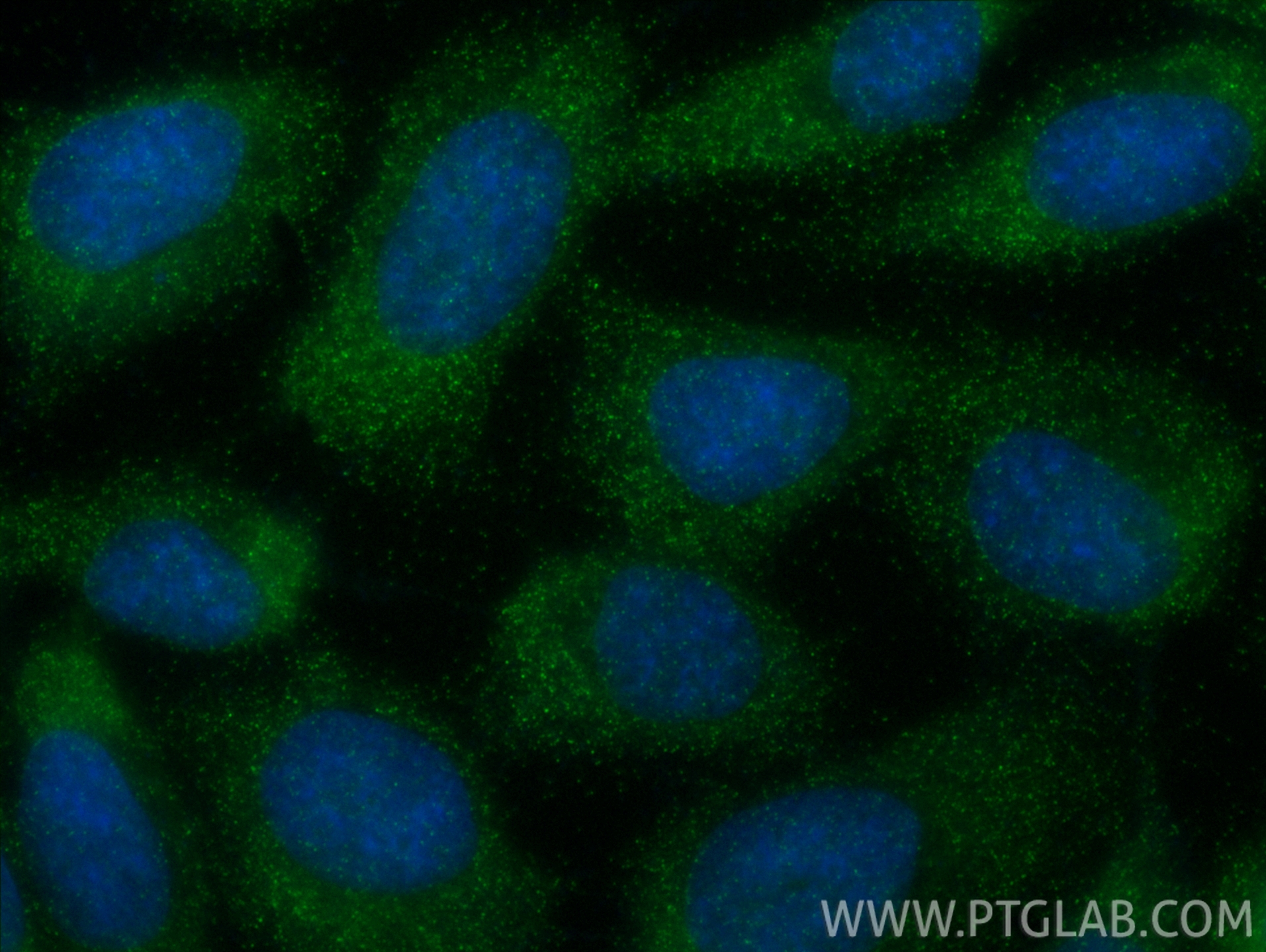 Immunofluorescent analysis of (-20°C Ethanol) fixed U-251 cells using SPARC antibody (<a class='green' href='/productredirect?CatalogNo=84621-3-RR' target='_blank'>84621-3-RR</a>, Clone: 241952E11 ) at dilution of 1:400 and CoraLite®488-Conjugated Goat Anti-Rabbit IgG(H+L) (<a class='green' href='/productredirect?CatalogNo=SA00013-2' target='_blank'>SA00013-2</a>). This data was developed using the same antibody clone with 84621-3-PBS in a different storage buffer formulation. IF Staining of U-251 using 84621-3-RR (same clone as 84621-3-PBS)