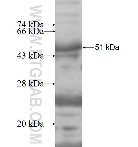 SPARC fusion protein Ag7869 SDS-PAGE SPARC fusion protein Ag7869 SDS-PAGE