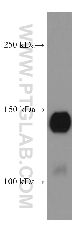 WB analysis of human saliva using 67511-1-Ig