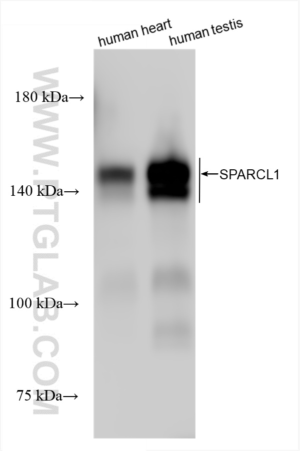 WB analysis using 85906-4-RR