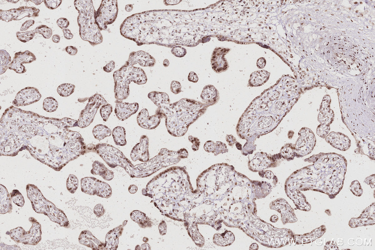 IHC staining of human placenta using 67361-1-Ig IHC staining of human placenta using 67361-1-Ig