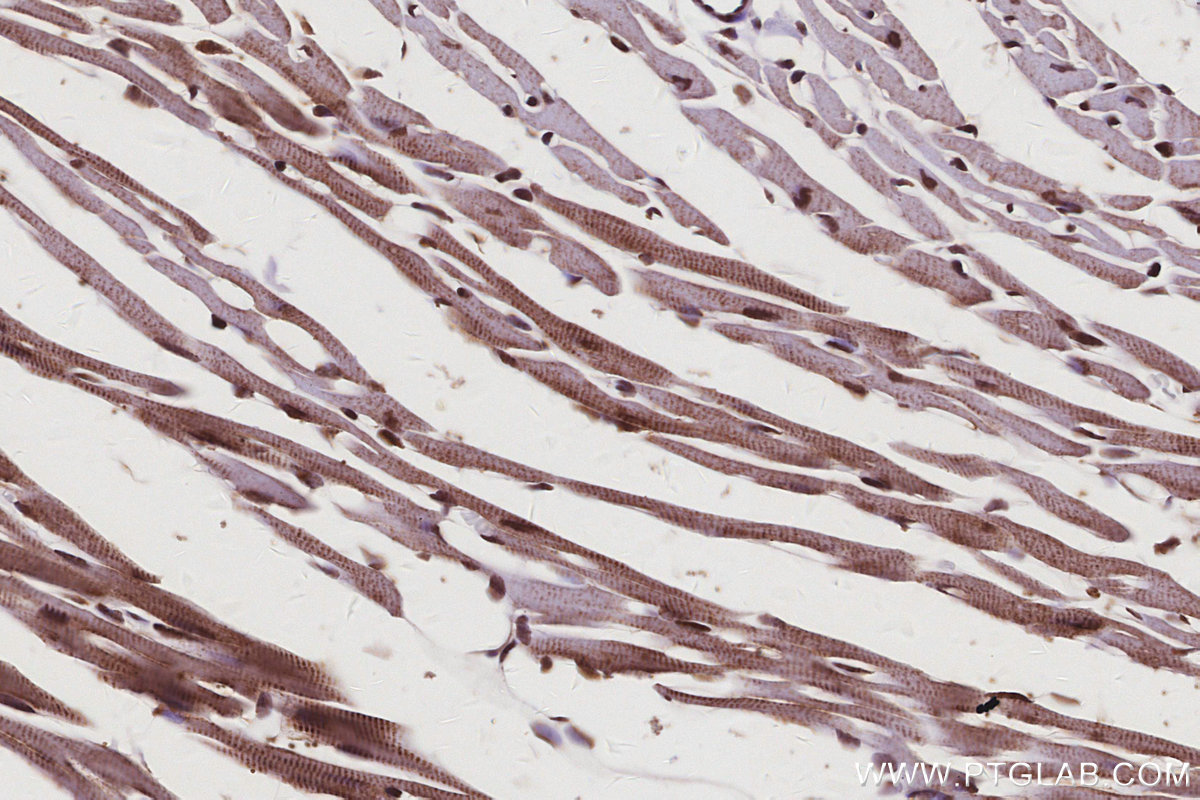 IHC staining of mouse heart using 67361-1-Ig IHC staining of mouse heart using 67361-1-Ig