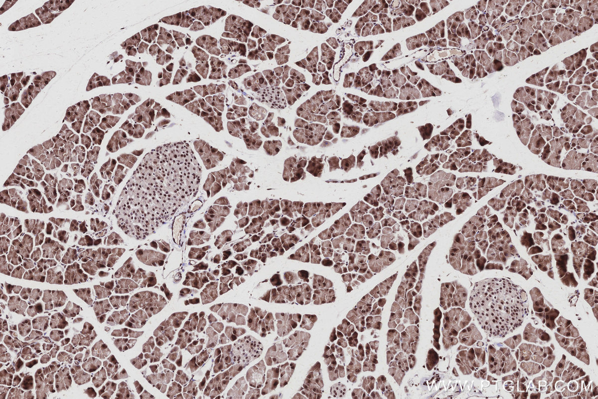 IHC staining of mouse pancreas using 67361-1-Ig IHC staining of mouse pancreas using 67361-1-Ig