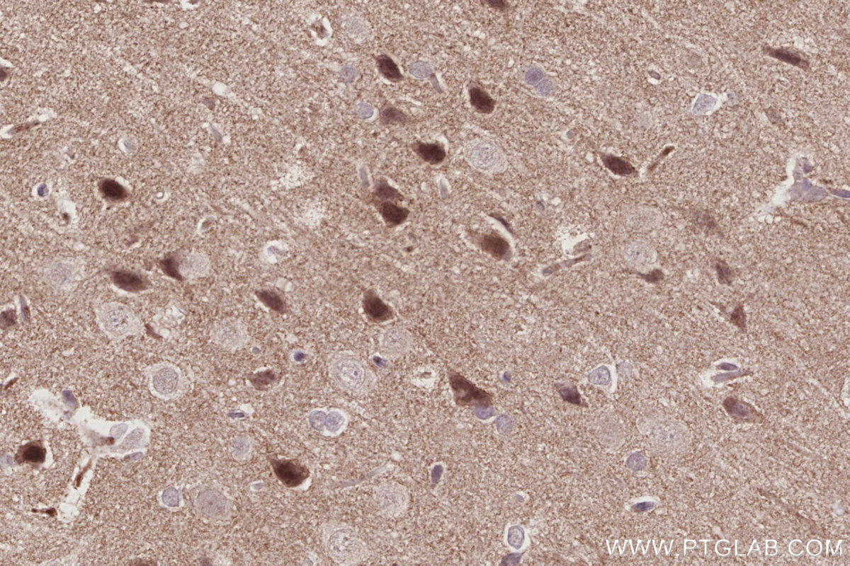 IHC staining of rat brain using 67361-1-Ig IHC staining of rat brain using 67361-1-Ig