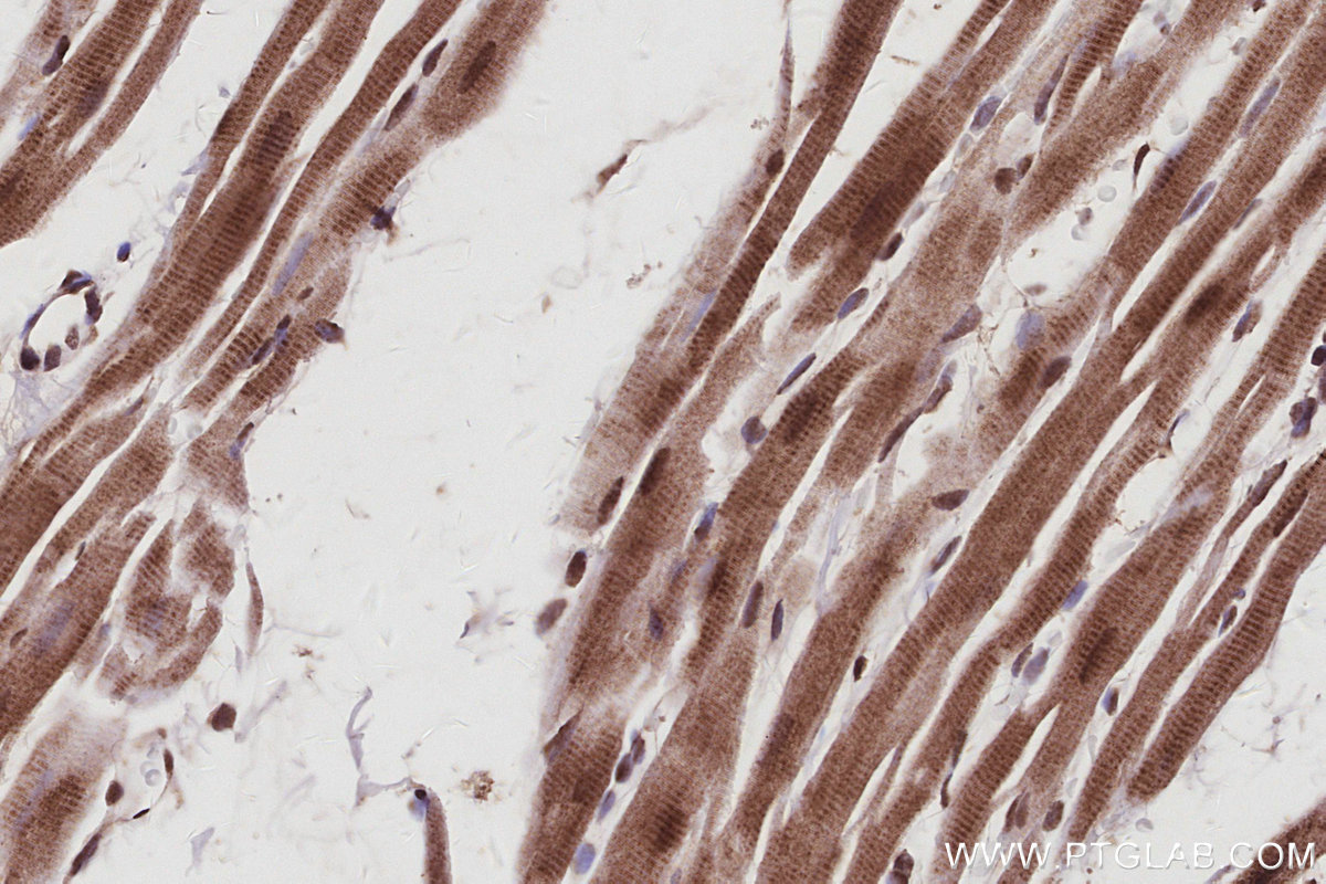 IHC staining of rat heart using 67361-1-Ig IHC staining of rat heart using 67361-1-Ig