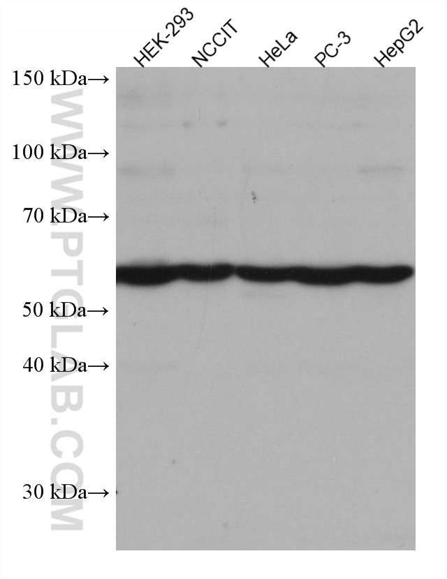 WB analysis using 67361-1-Ig