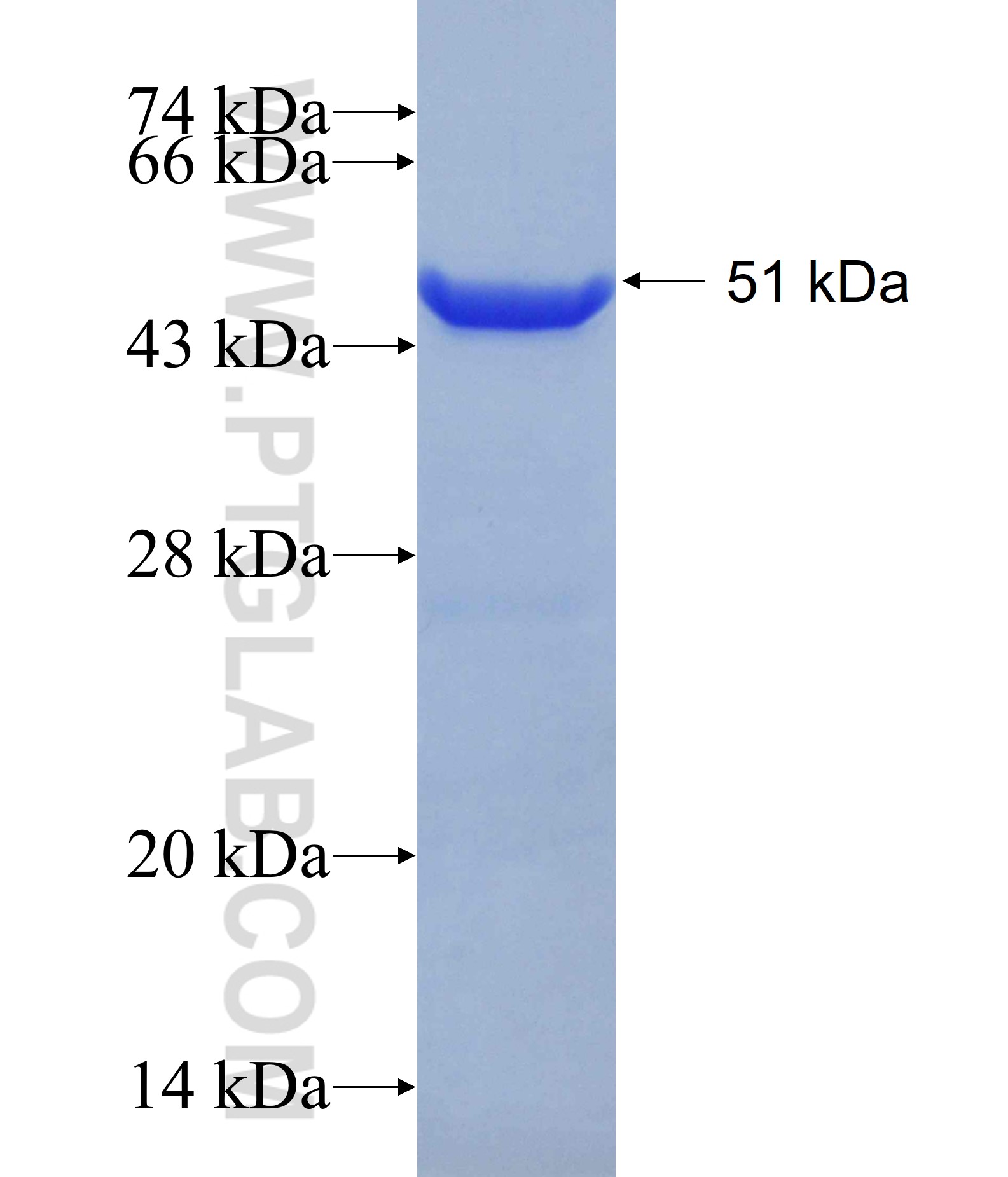 SPAST fusion protein Ag18797 SDS-PAGE