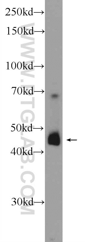 WB analysis of human testis using 24980-1-AP