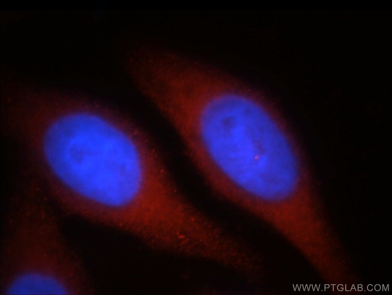 IF Staining of HepG2 using 21400-1-AP