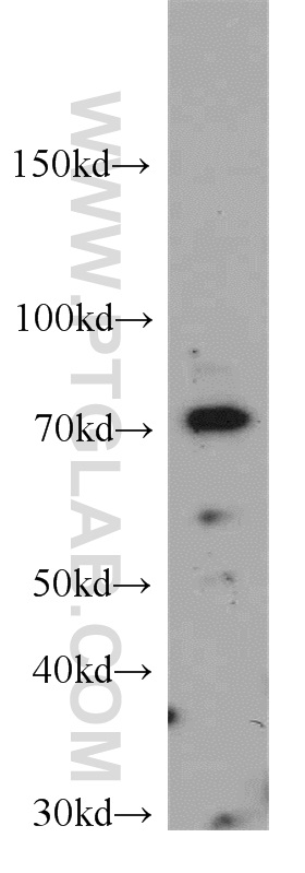 WB analysis of COLO 320 using 21400-1-AP