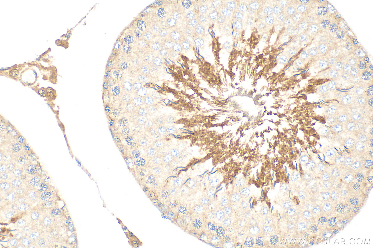 Immunohistochemical analysis of paraffin-embedded rat testis tissue slide using 31808-1-AP (SPATA18 antibody) at dilution of 1:400 (under 40x lens). Heat mediated antigen retrieval with Tris-EDTA buffer (pH 9.0). IHC staining of rat testis using 31808-1-AP