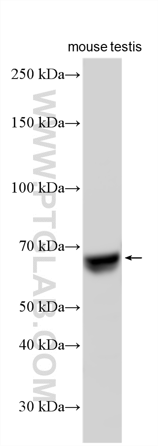 Mouse testis tissue lysate was subjected to SDS PAGE followed by western blot with 31808-1-AP (SPATA18 antibody) at dilution of 1:3000 incubated at room temperature for 1.5 hours. WB analysis using 31808-1-AP