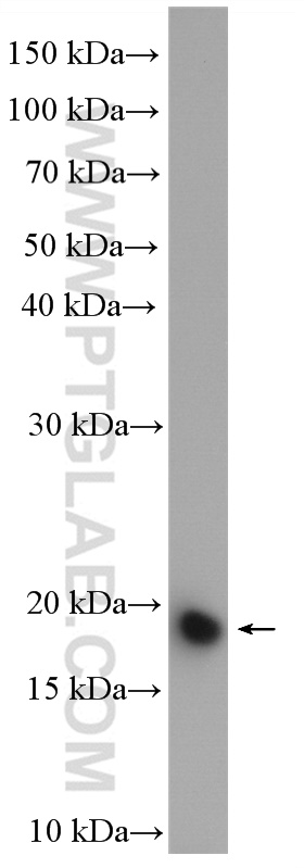 WB analysis of mouse testis using 16656-1-AP