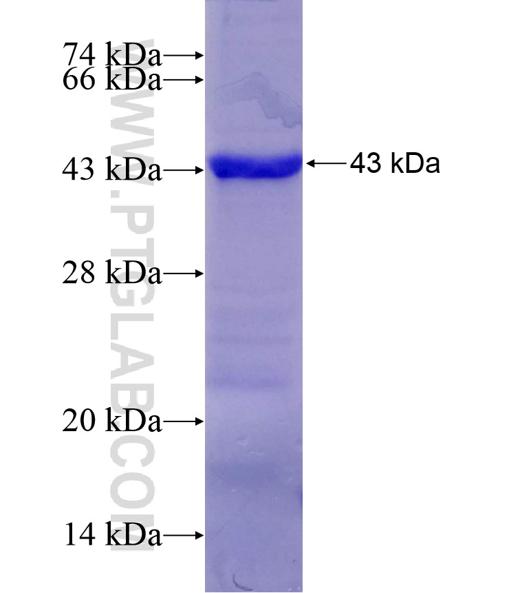 SPATA2 fusion protein Ag28274 SDS-PAGE SPATA2 fusion protein Ag28274 SDS-PAGE