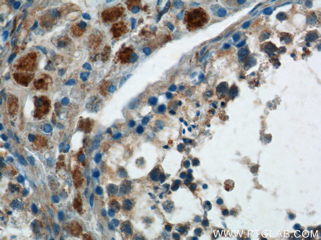 IHC staining of human testis using 17500-1-AP