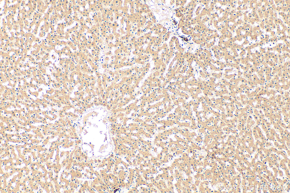 IHC staining of human liver using 32104-1-AP