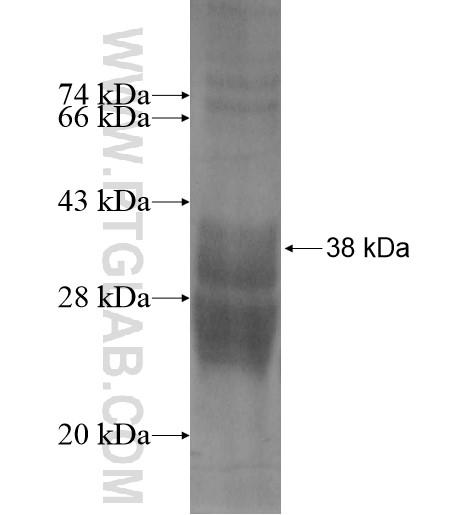 SPATA8 fusion protein Ag13680 SDS-PAGE SPATA8 fusion protein Ag13680 SDS-PAGE