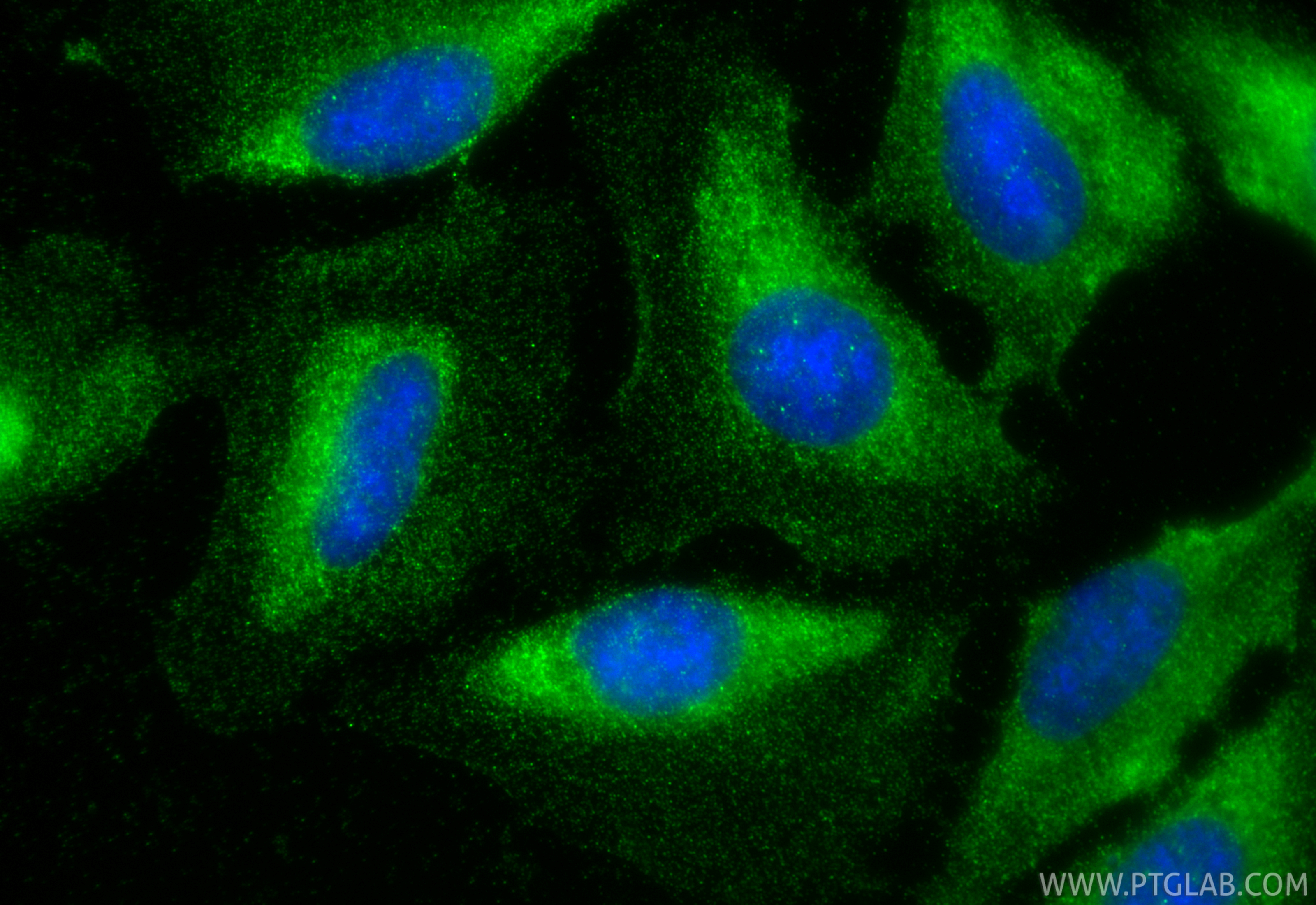 IF Staining of U2OS using 26474-1-AP IF Staining of U2OS using 26474-1-AP