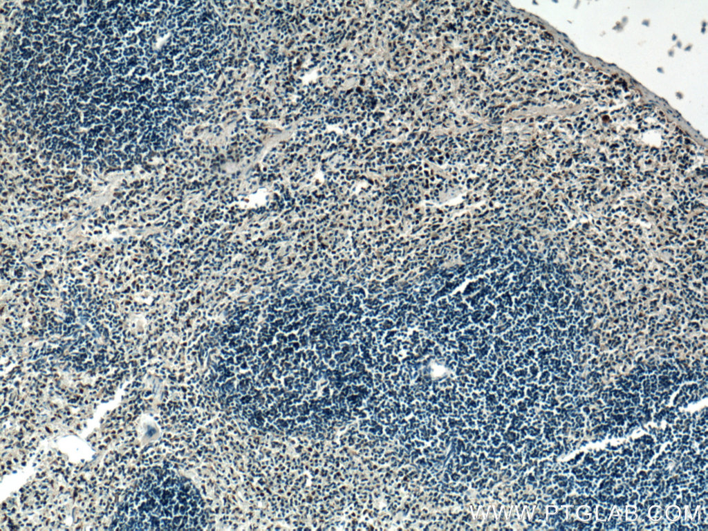 IHC staining of mouse spleen using 26474-1-AP