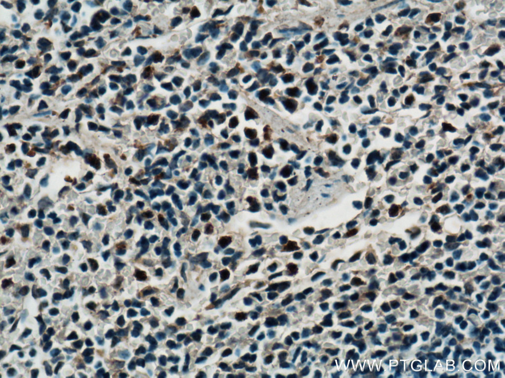 IHC staining of mouse spleen using 26474-1-AP
