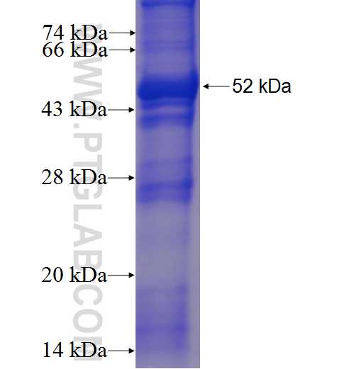 SPC25 fusion protein Ag23985 SDS-PAGE
