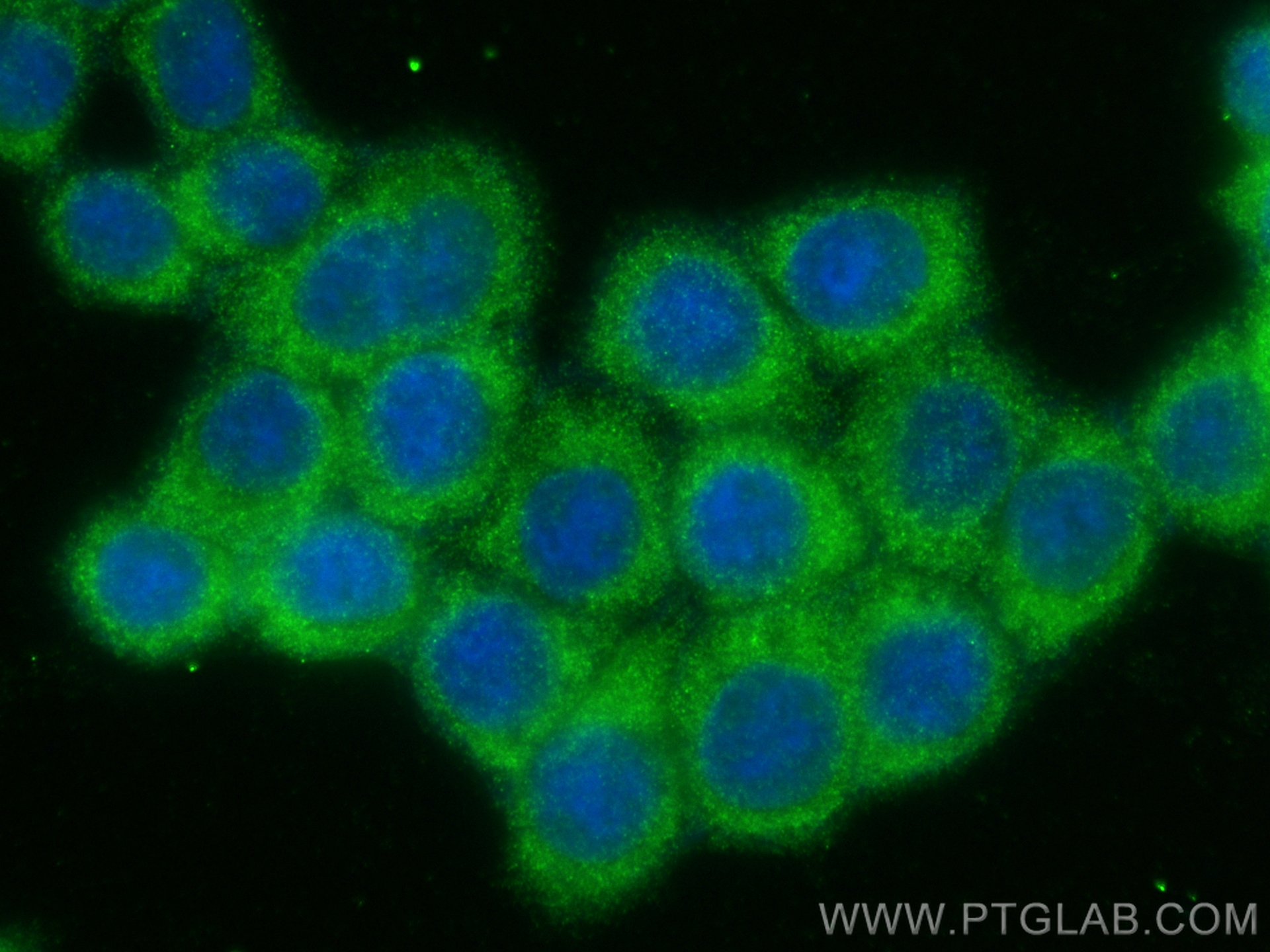 IF Staining of BxPC-3 using 11847-1-AP