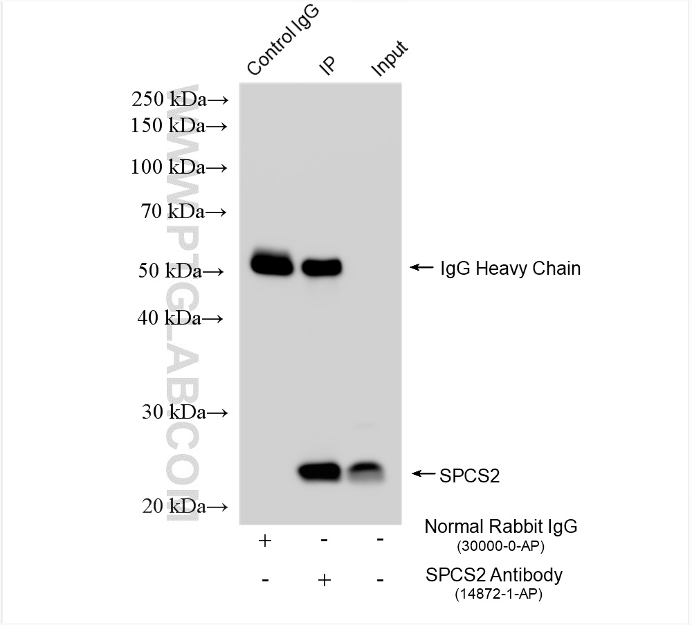 IP experiment of HeLa using 14872-1-AP