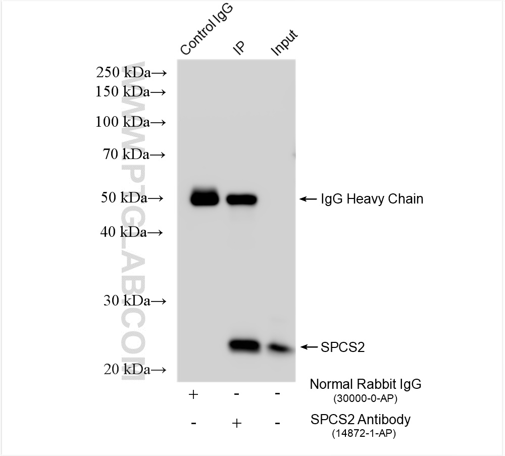 IP experiment of mouse colon using 14872-1-AP
