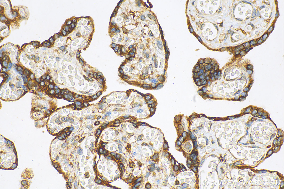 IHC staining of human placenta using 17640-1-AP