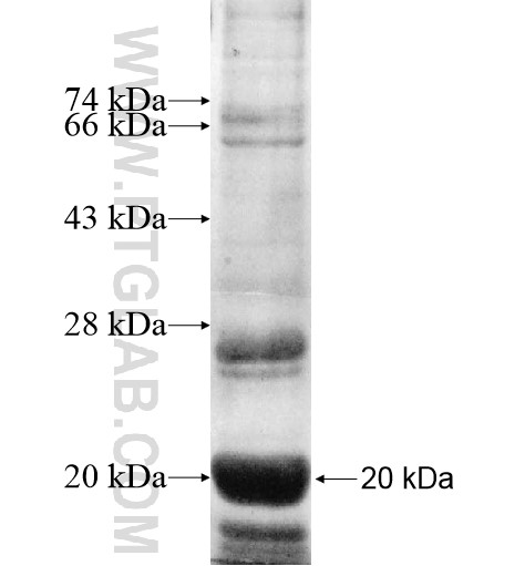 SPCS3 fusion protein Ag11689 SDS-PAGE SPCS3 fusion protein Ag11689 SDS-PAGE