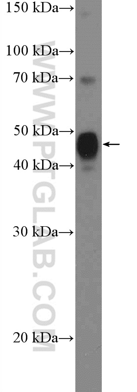 WB analysis of MCF-7 using 11467-1-AP