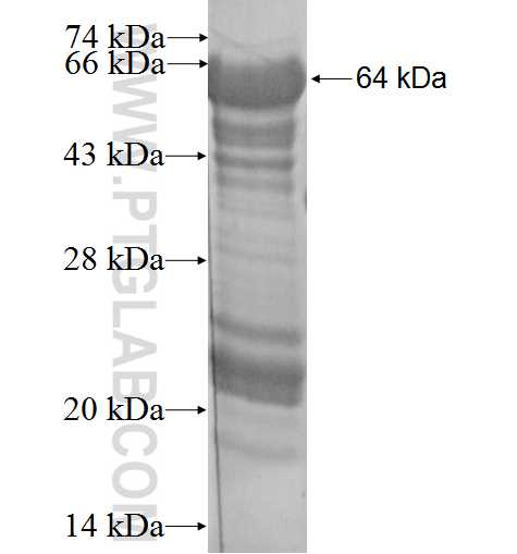 SPDEF fusion protein Ag2020 SDS-PAGE