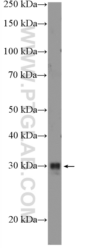 WB analysis of Neuro-2a using 17836-1-AP