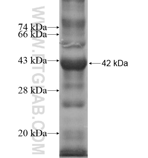 SPDYA fusion protein Ag12218 SDS-PAGE SPDYA fusion protein Ag12218 SDS-PAGE