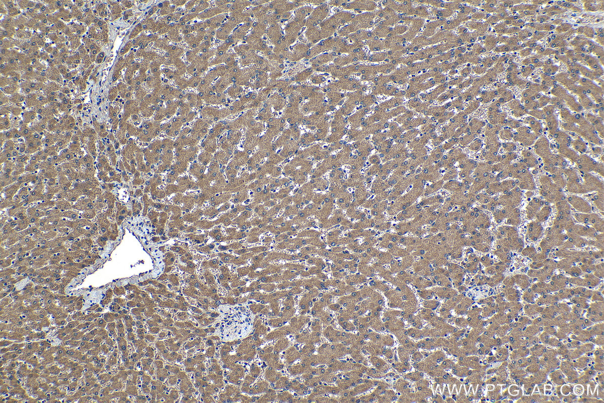 Immunohistochemical analysis of paraffin-embedded human liver tissue slide using 22471-1-AP (SPDYC antibody) at dilution of 1:500 (under 10x lens). Heat mediated antigen retrieval with Tris-EDTA buffer (pH 9.0). IHC staining of human liver using 22471-1-AP