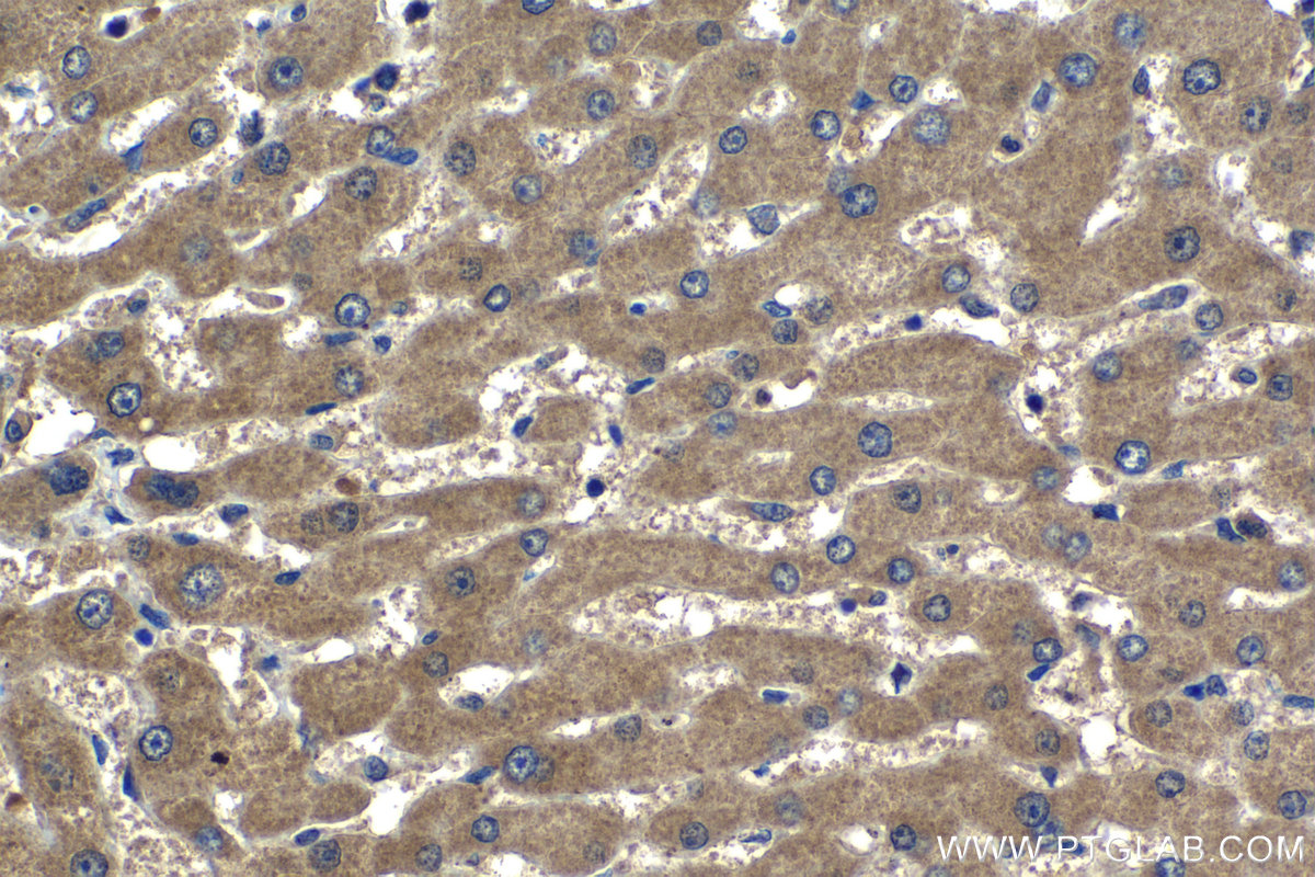 Immunohistochemical analysis of paraffin-embedded human liver tissue slide using 22471-1-AP (SPDYC antibody) at dilution of 1:500 (under 40x lens). Heat mediated antigen retrieval with Tris-EDTA buffer (pH 9.0). IHC staining of human liver using 22471-1-AP