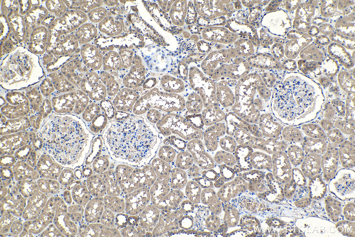 Immunohistochemical analysis of paraffin-embedded human kidney tissue slide using 22471-1-AP (SPDYC antibody) at dilution of 1:500 (under 10x lens). Heat mediated antigen retrieval with Tris-EDTA buffer (pH 9.0). IHC staining of human kidney using 22471-1-AP