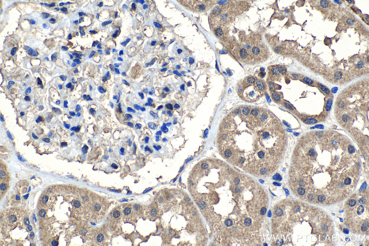 Immunohistochemical analysis of paraffin-embedded human kidney tissue slide using 22471-1-AP (SPDYC antibody) at dilution of 1:500 (under 40x lens). Heat mediated antigen retrieval with Tris-EDTA buffer (pH 9.0). IHC staining of human kidney using 22471-1-AP