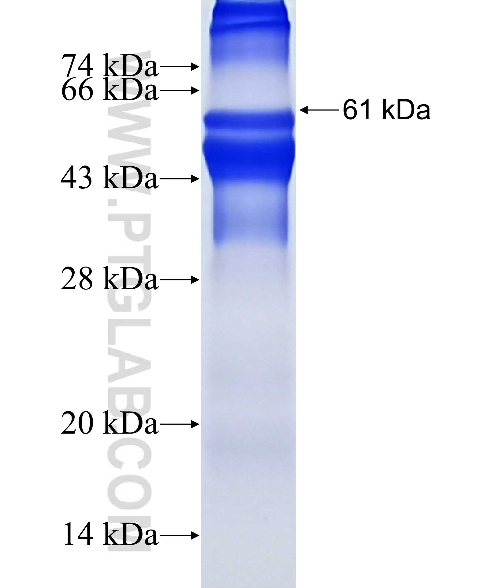 SPDYC fusion protein Ag18126 SDS-PAGE SPDYC fusion protein Ag18126 SDS-PAGE