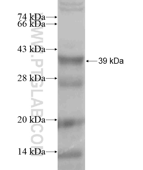SPDYC fusion protein Ag18754 SDS-PAGE SPDYC fusion protein Ag18754 SDS-PAGE