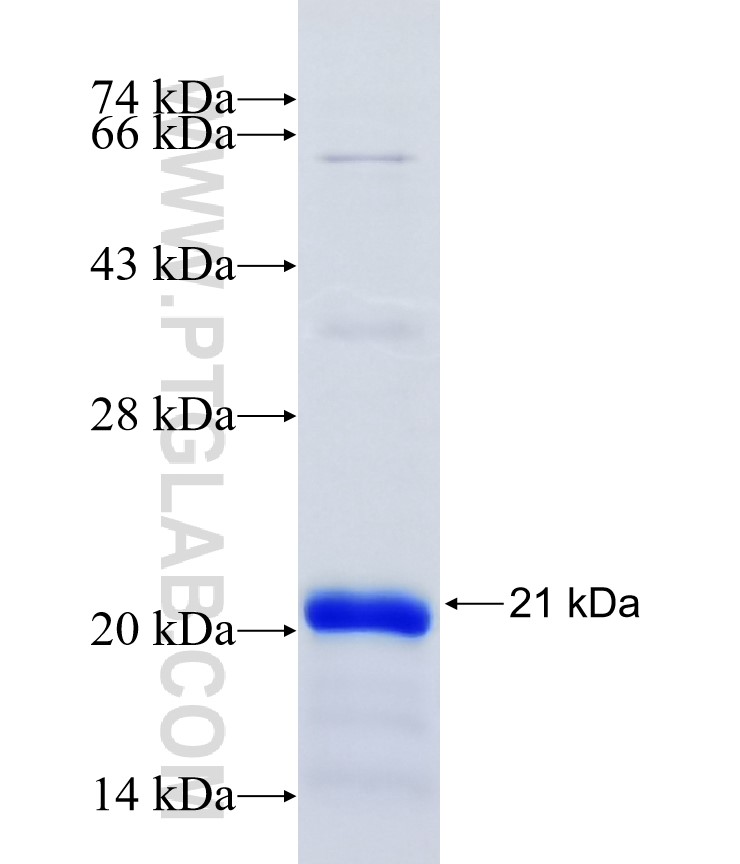 SPEF1 fusion protein Ag23488 SDS-PAGE SPEF1 fusion protein Ag23488 SDS-PAGE