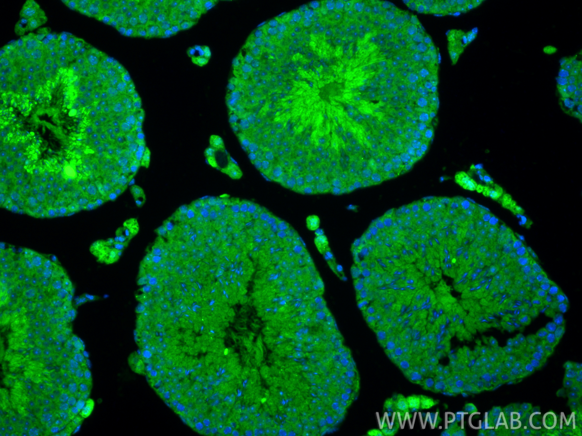 IF Staining of mouse testis using 27989-1-AP IF Staining of mouse testis using 27989-1-AP
