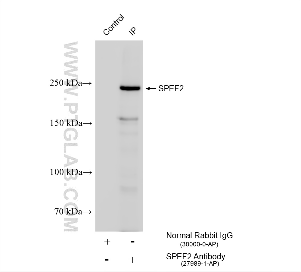 IP experiment of rat testis using 27989-1-AP IP experiment of rat testis using 27989-1-AP