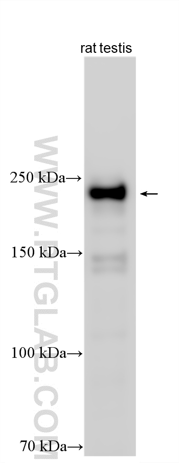 WB analysis using 27989-1-AP WB analysis using 27989-1-AP