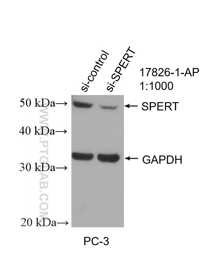 WB analysis of PC-3 using 17826-1-AP
