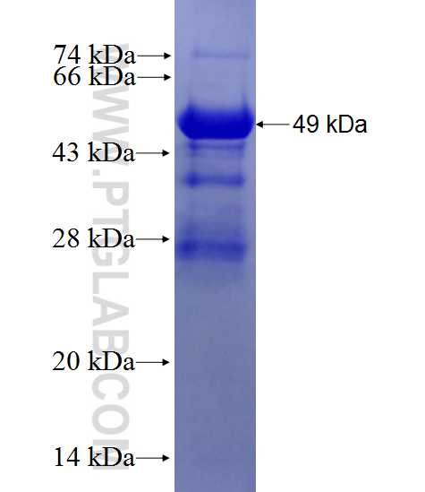 SPESP1 fusion protein Ag27764 SDS-PAGE