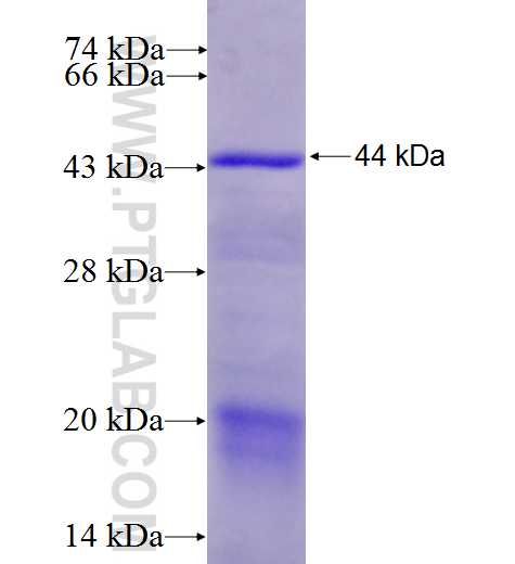 SPG11 fusion protein Ag9716 SDS-PAGE SPG11 fusion protein Ag9716 SDS-PAGE