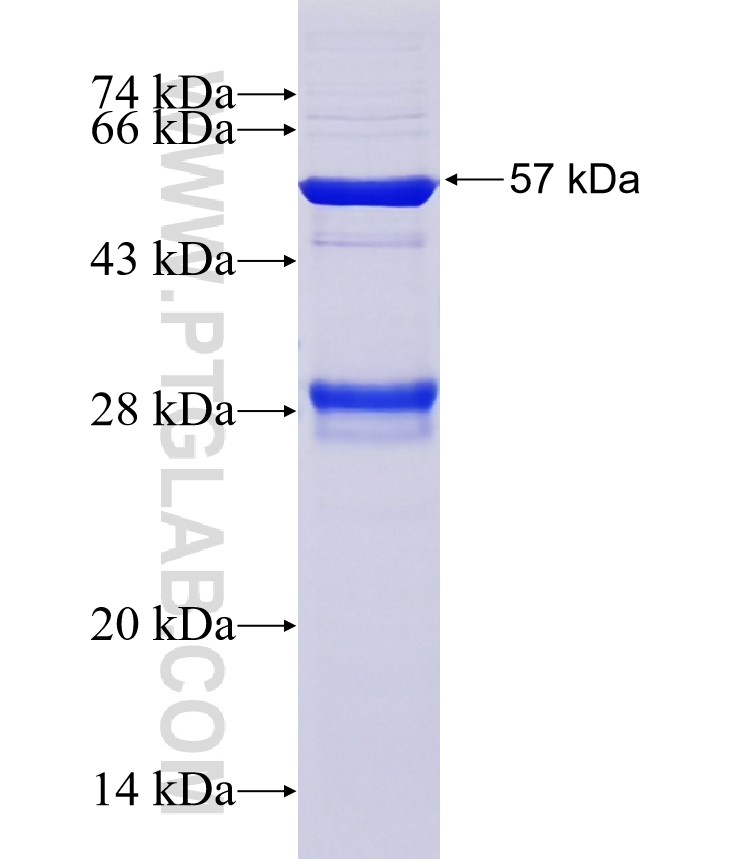 SPG21 fusion protein Ag13851 SDS-PAGE SPG21 fusion protein Ag13851 SDS-PAGE