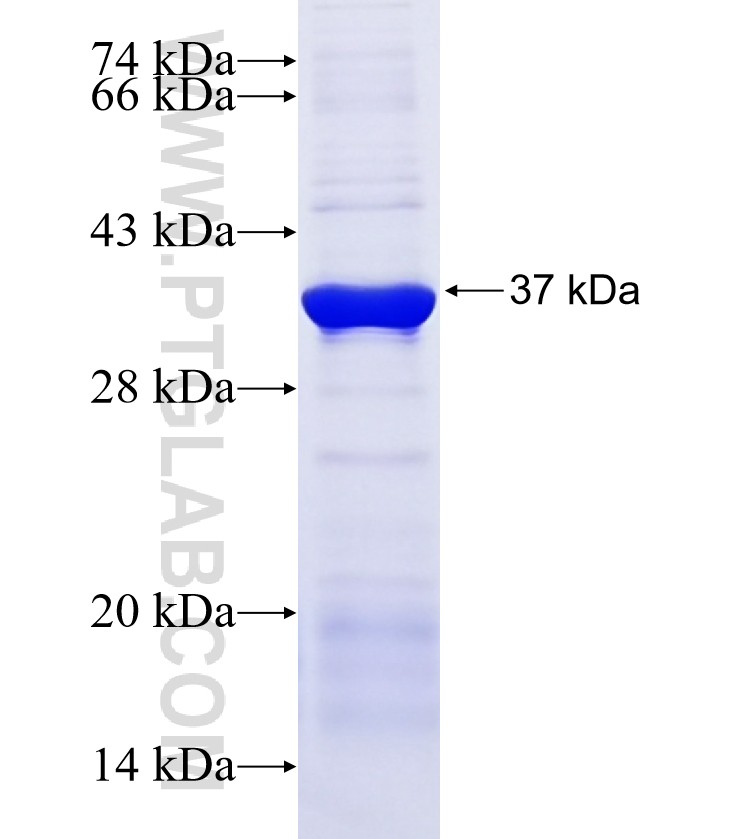 SPG21 fusion protein Ag14879 SDS-PAGE SPG21 fusion protein Ag14879 SDS-PAGE